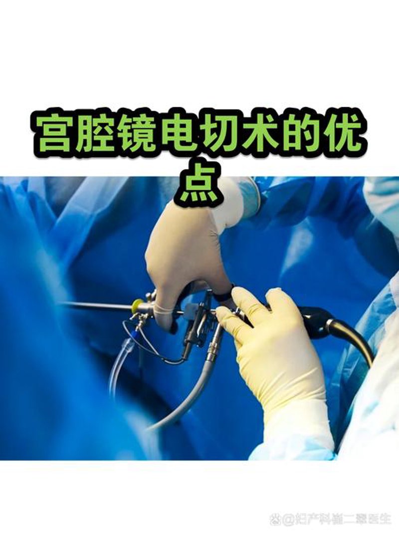 妇科微创手术